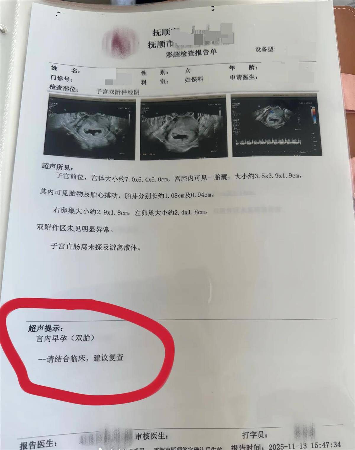 怎么开通皇冠信用开户_辽宁一孕妇两个月内从一胎变四胞胎怎么开通皇冠信用开户,每次产检发现多出一胎,医生:系同卵四胞胎,概率1300万至1500万分之一